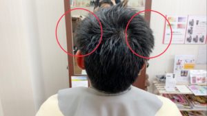 【大阪 堺】南海本線堺駅近く、ライフヘアーにて6mmのバリカンを使った髪型をカットする注意点の写真。